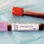 fibrinogeno la proteina que podria salvar tu corazon