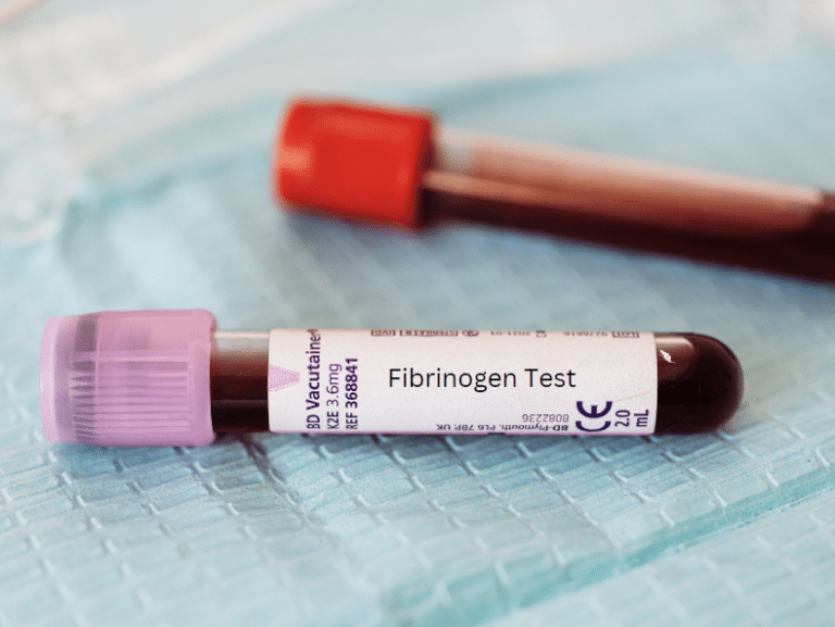 fibrinogeno la proteina que podria salvar tu corazon